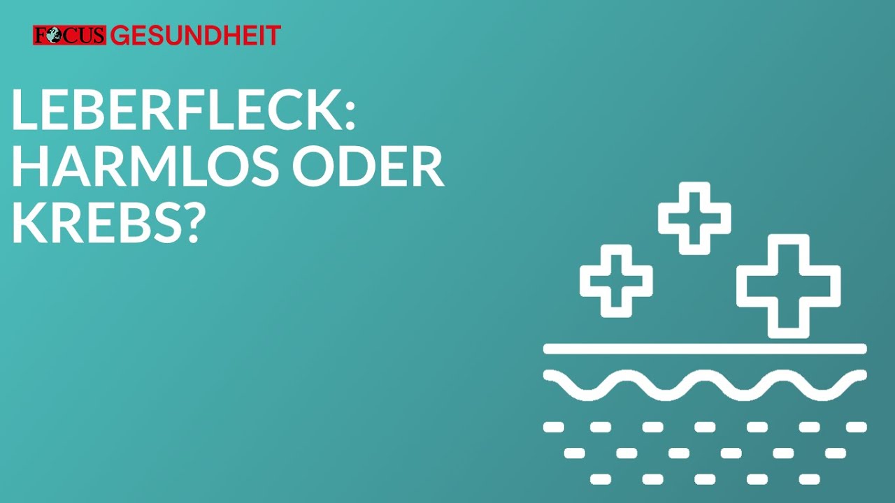 Leberfleck: Harmlos oder Krebs?