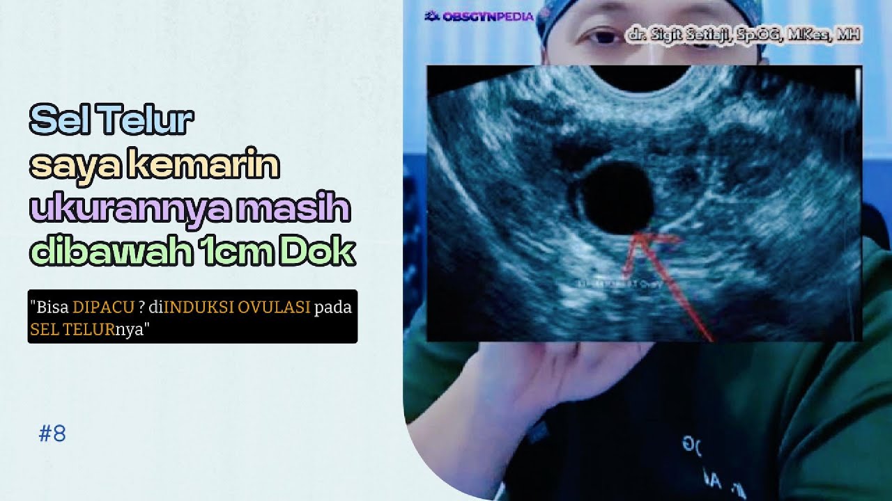 Ukuran Sel Telur masih dibawah 1cm bisa dipacu ?