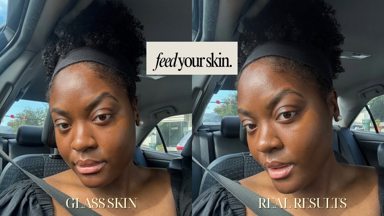 How to Get Clear Skin Naturally | 5 Things That Changed My Skin | Habits That Actually WORK!