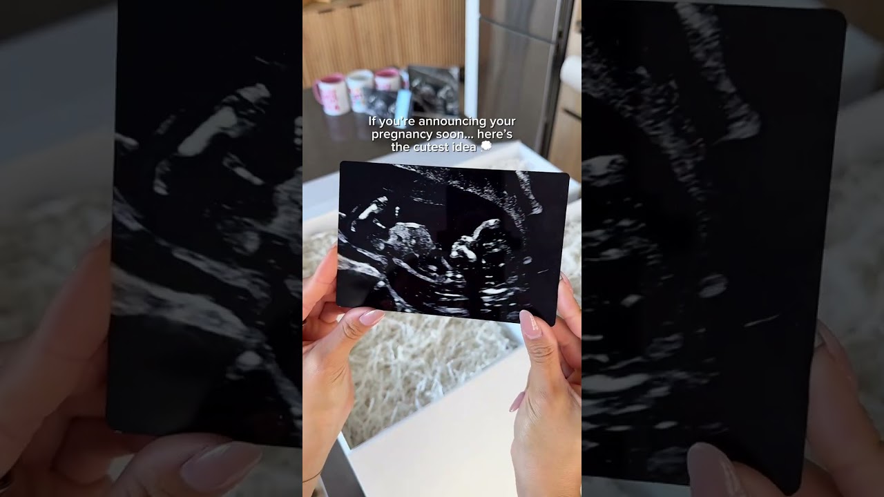 Holiday Pregnancy Announcement Idea 🎁 Creative Ultrasound Gift Reveal with Mixbook