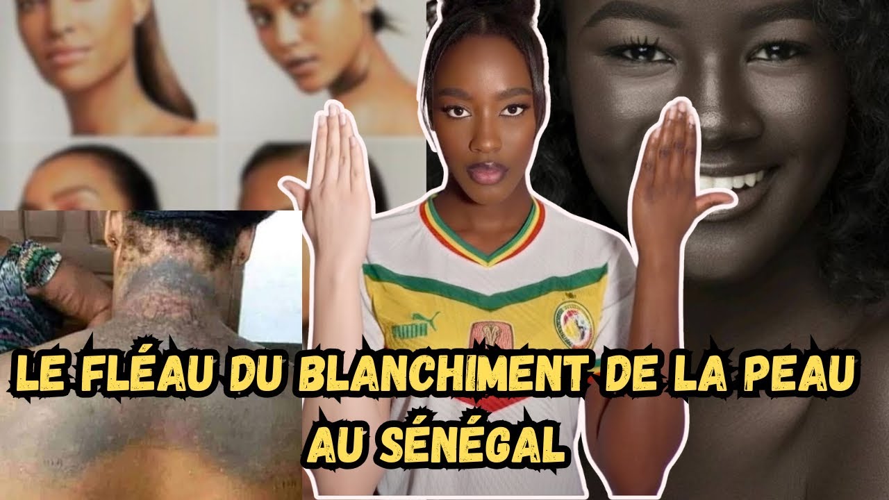 Xessal au Sénégal : la honte de la peau noire? #Xessal #depigmentation #peaunoire #senegal #afrique 