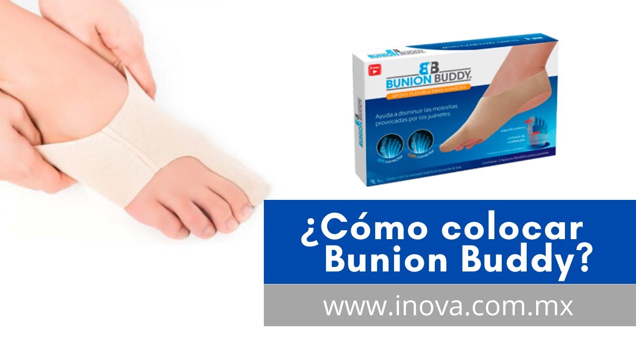 &iquest;C&oacute;mo se  coloca Bunion Buddy?