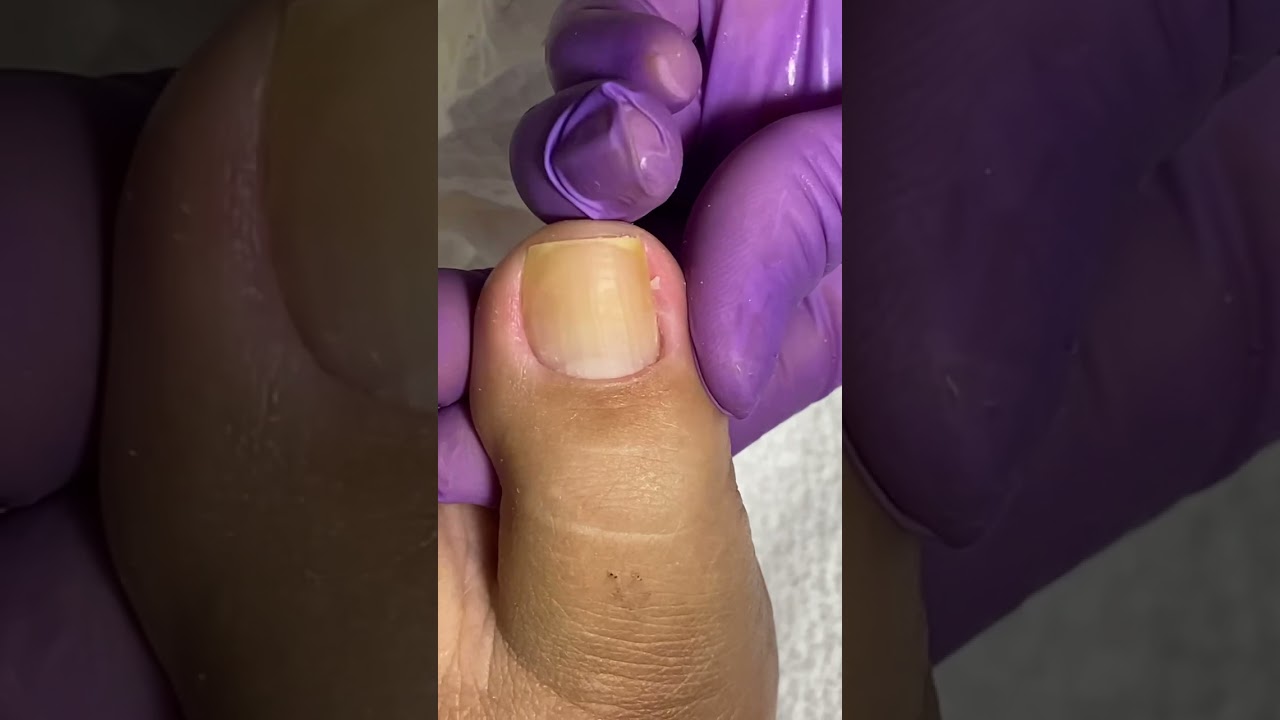 Cutículagem Pedicure #cuticulagem #cuticula #pedicures #pedicures #videoshort #videos