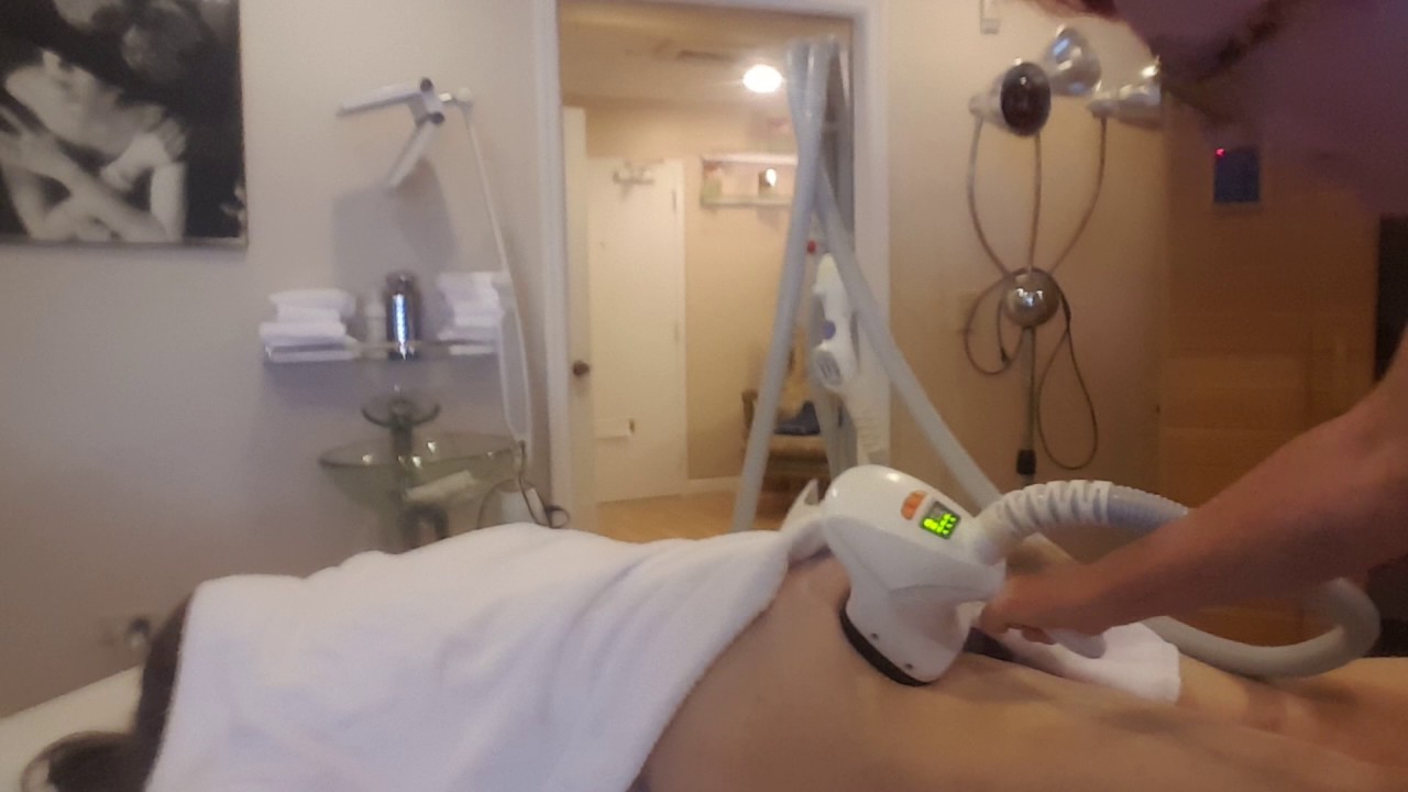 Butt Lift VelaShape Treatments (Miami, FL)