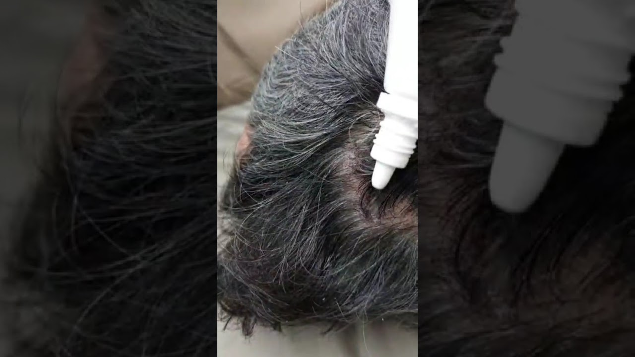 Saç ASMR 🎧  RelXing hair care. #asmrsaç #asmrrelaxing #asmrvideo #rahatlamavemeditasyon  #relaxing