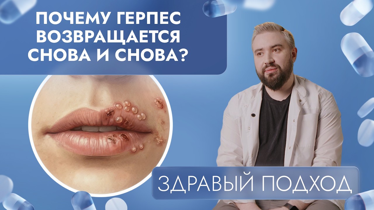Почему герпес возвращается снова и снова? | Здравый подход (2026)