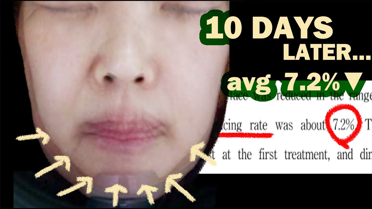 NO ADS) Face Sculpting Massage 12 Steps proven by data #massage #face exercise