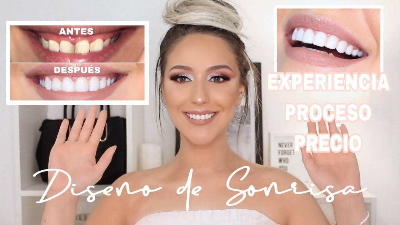 MI EXPERIENCIA DISEÑO DE SONRISA | Melina Quiroga Makeup
