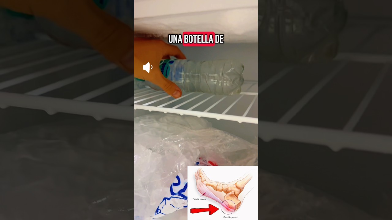 El ejercicio diario que alivia tu fascitis plantar