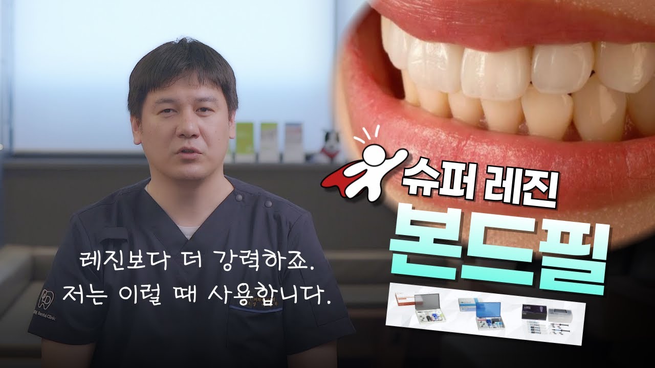 레진은 레진인데, 슈퍼 레진이라고 하죠. 본드필 소개를 드릴게요.