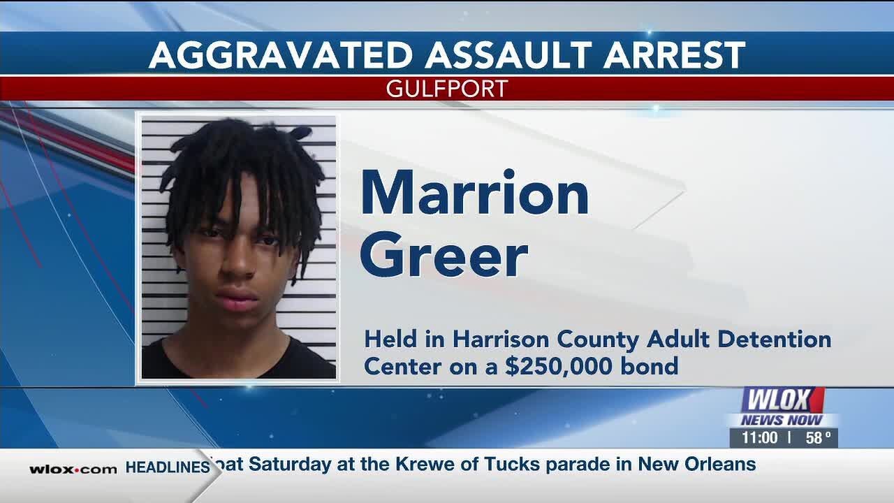 Gulfport teen charged after shooting injures 14-year-old in fight over female, police say