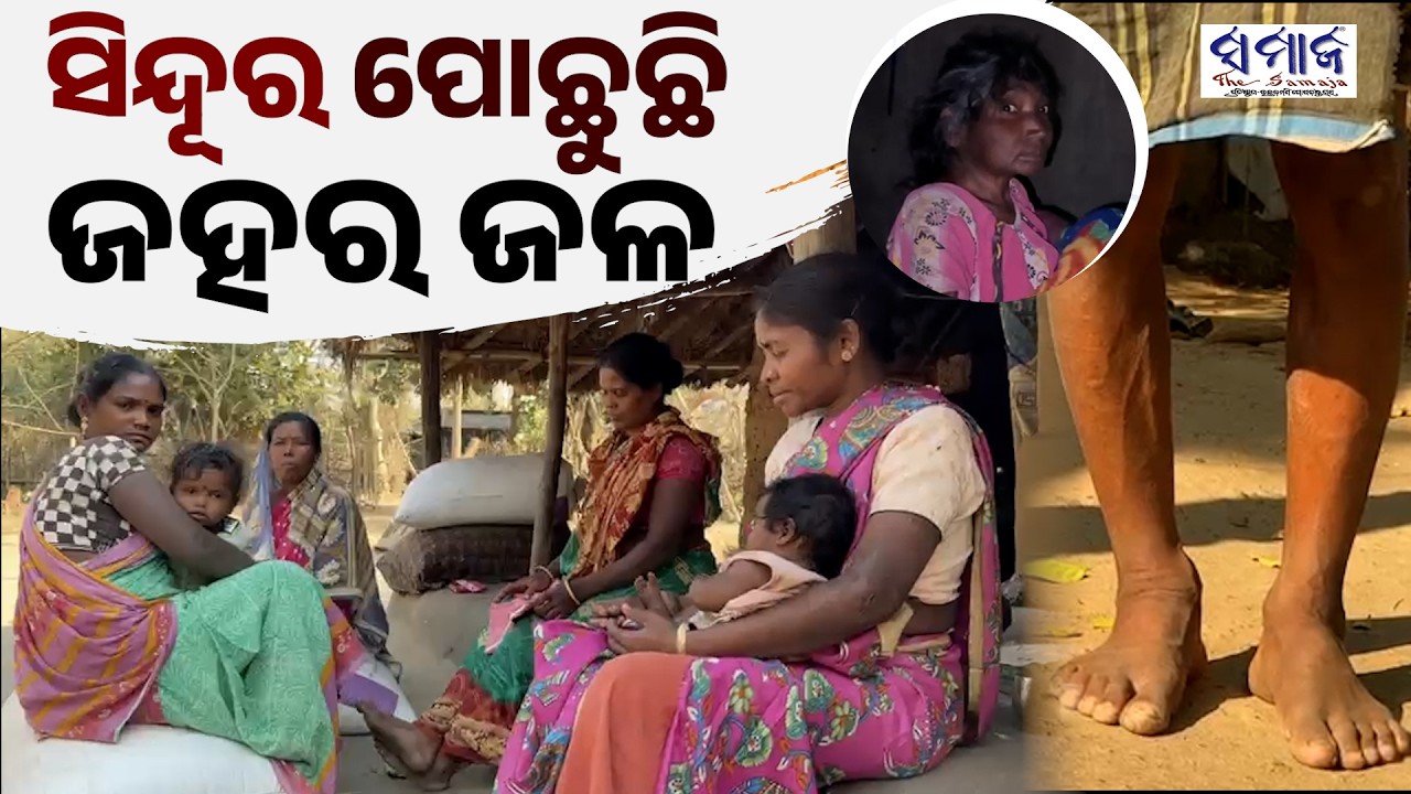 ନୀଳଗିରି ହାତୀଆଶିଳା: ଯମ ପାଲଟିଛି ଫ୍ଲୋରାଇଡ ମିଶା ପାଣି