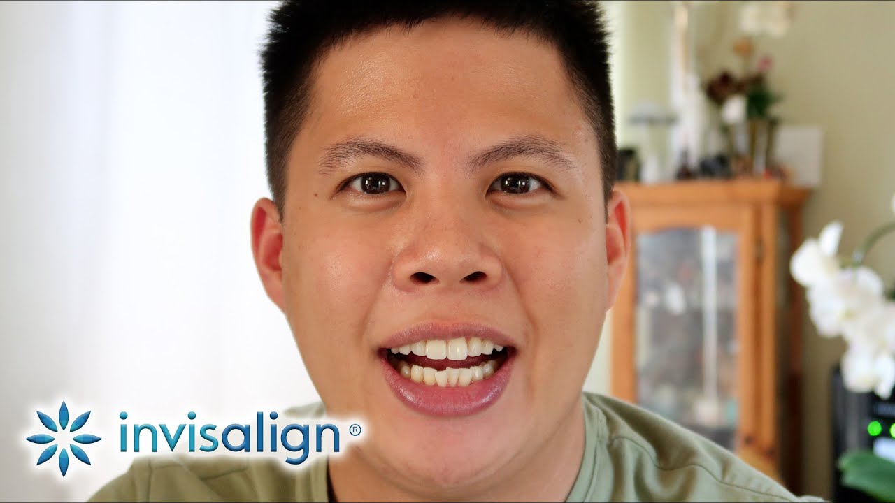 Ep. 1,381: STARTING MY INVISALIGN JOURNEY