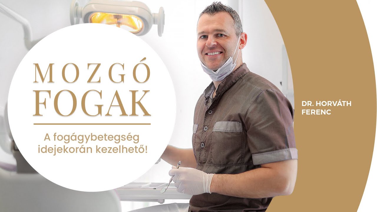Mozgó fogak - a fogágybetegség idejekorán kezelhető! - Implant Központ Buda