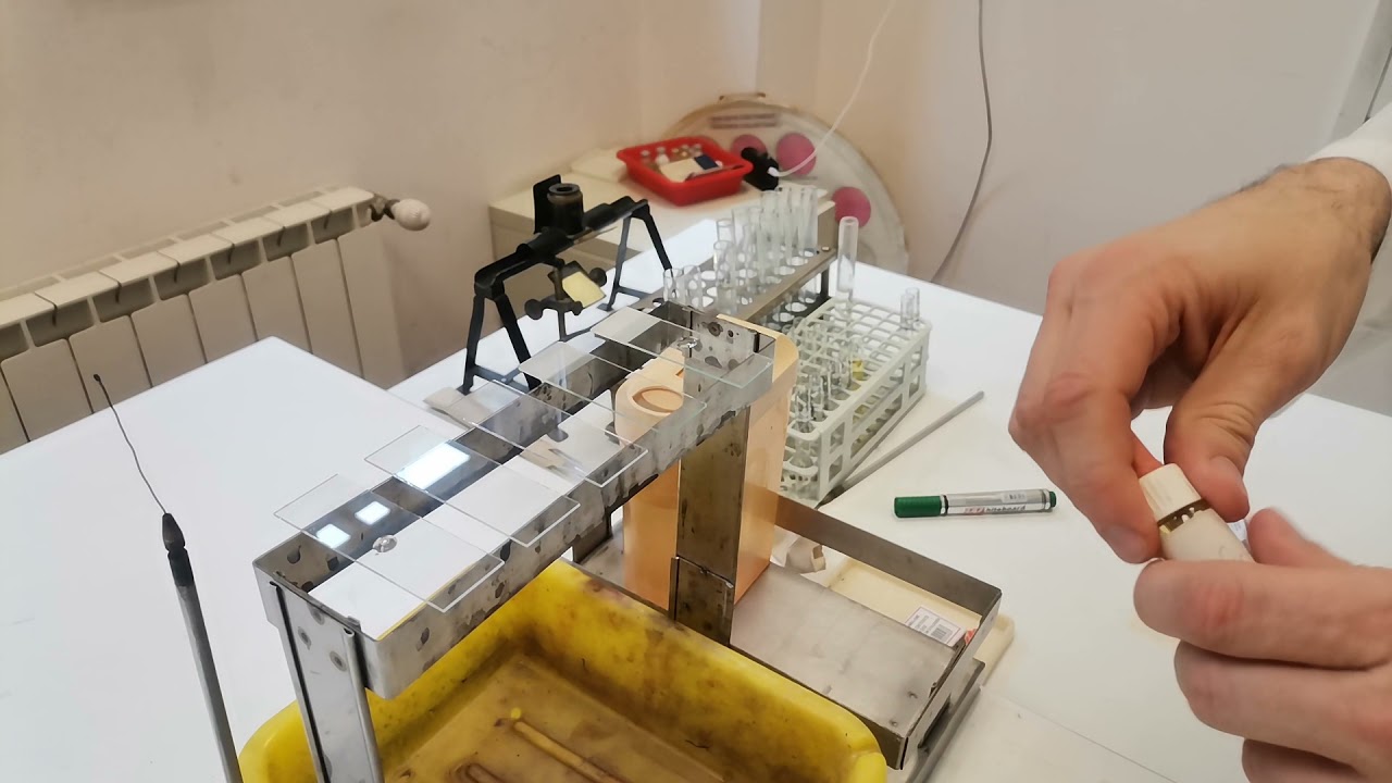 Slide Agglutination Test (Gruber reaction)