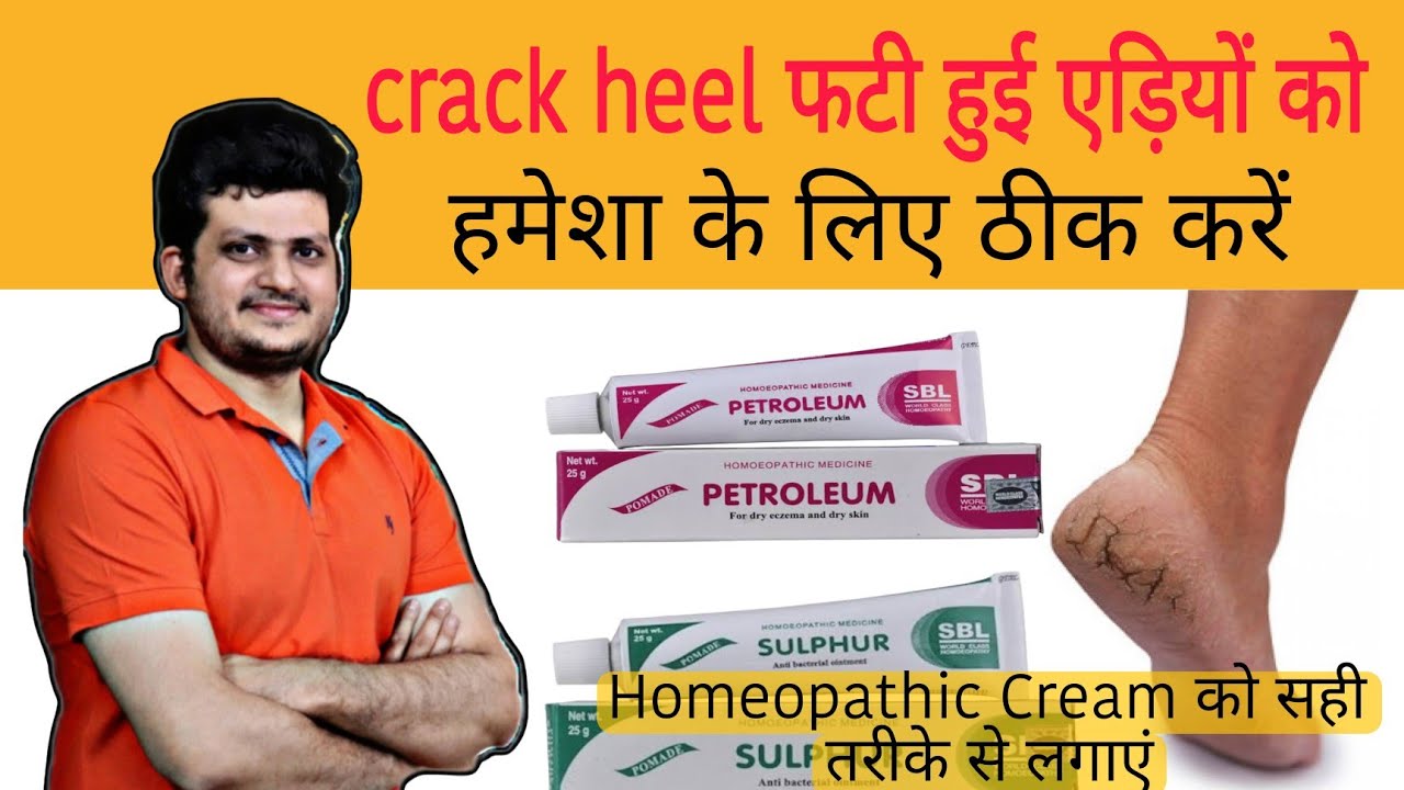 Crack Heel फटी हुई एड़ियां को हमेशा के लिए ठीक करें | heal cracked heels | Homeopathic Medicine |
