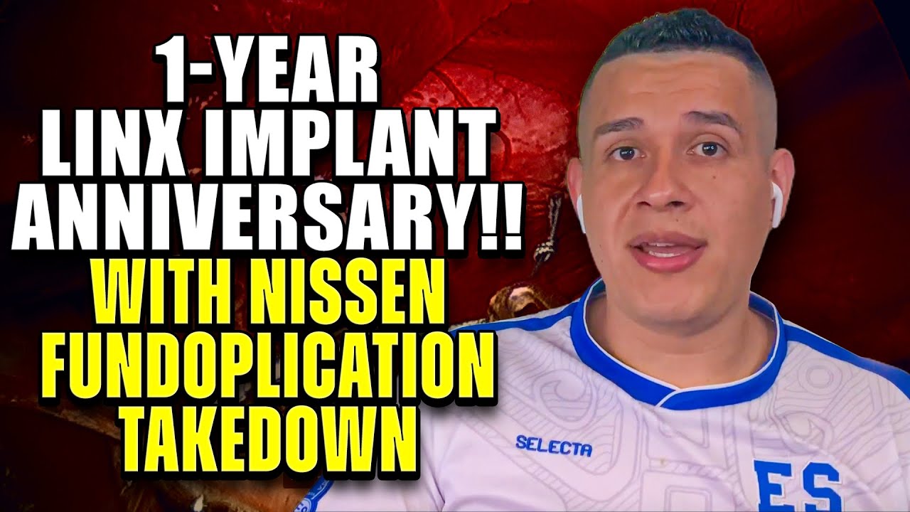 1-Year LINX Anniversary!! (With Nissen Fundoplication Takedown)