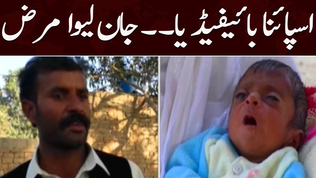 Spina Bifida makes worrying situation in villages | Samaa News