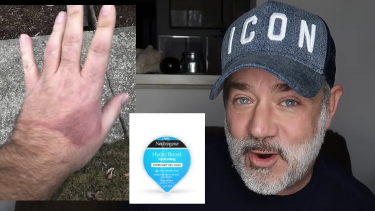 THIS NEUTROGENA FACE MASK HELPED MY BURN!