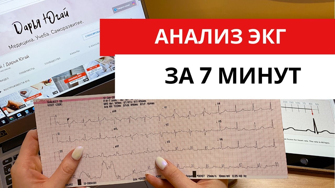 Научись анализировать ЭКГ за 7 минут!!! (Подробный разбор ЭКГ).