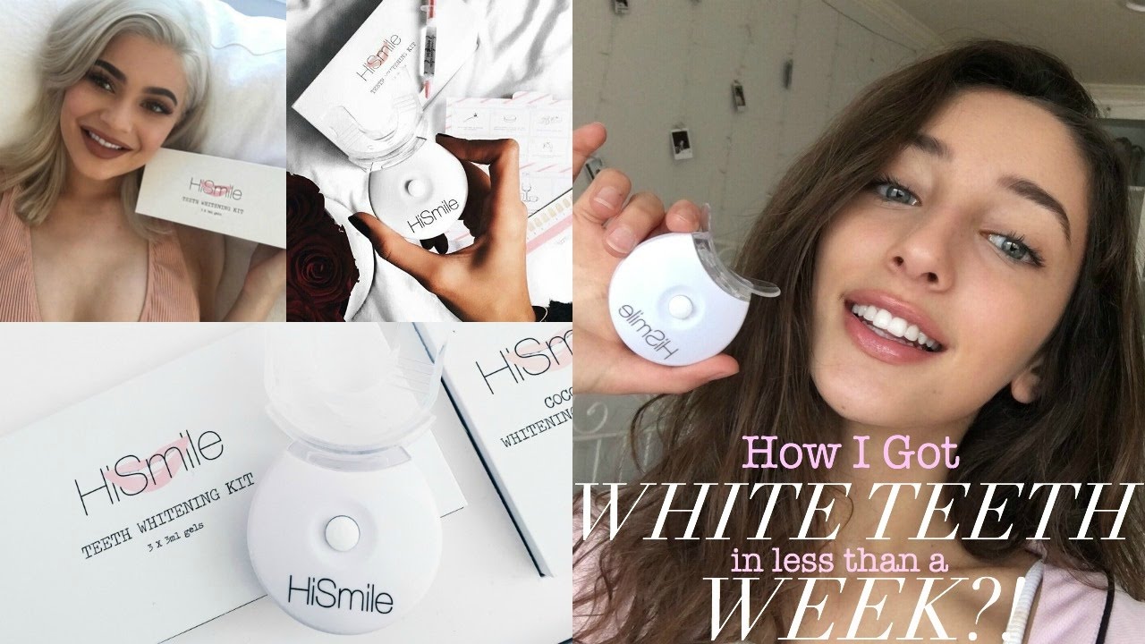 How I Got WHITE Teeth in Less Than a Week?! | Nil Sani