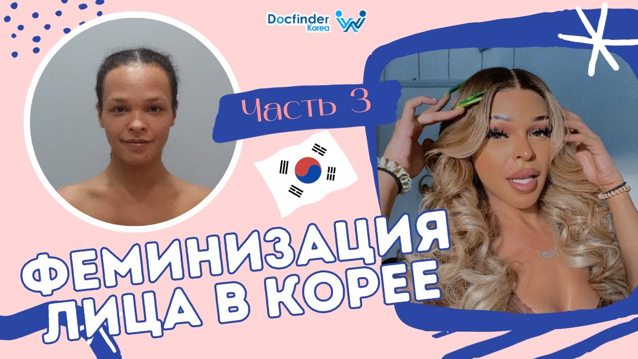 ФЕМИНИЗАЦИЯ В КОРЕЕ - Jazlynn Westbrook. 6 процедур за один раз!😍 Часть 3