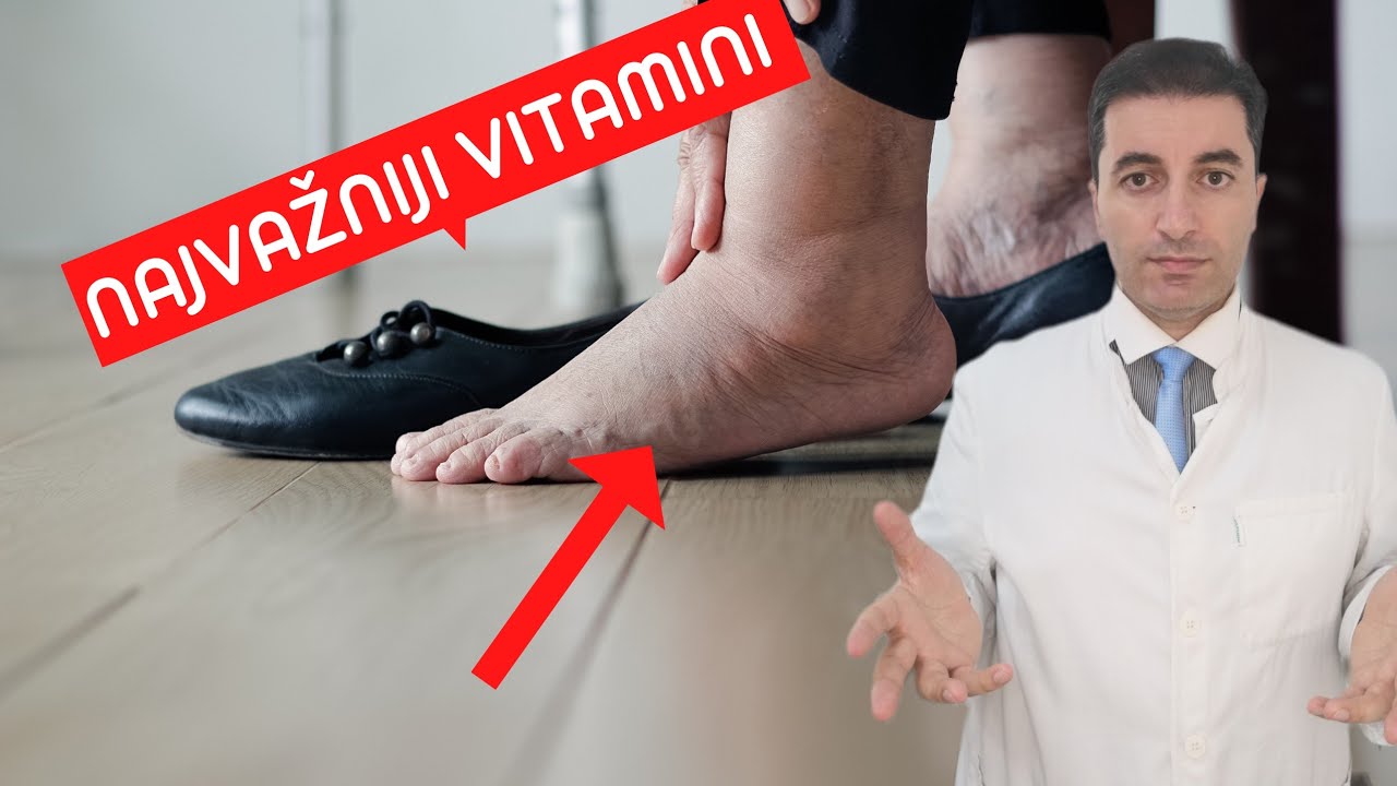 Самые важные ВИТАМИНЫ от отёков ног, лодыжек и ступней!