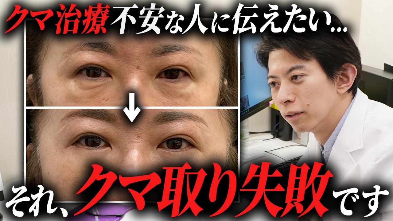 【救済動画】泣き寝入りする前に見て！後悔で終わらないクマ治療の修正方法の徹底解説5選！！
