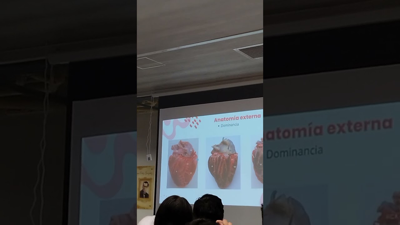Anatomía externa del corazón (parte 4)