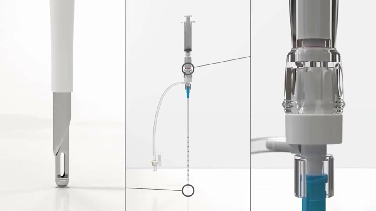 Safe-T-Centesis™ catheter drainage system video