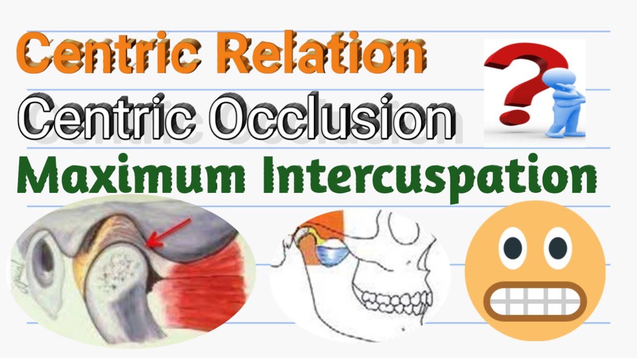 Concept of CENTRIC RELATION, CENTRIC OCCLUSION, MAXIMUM INTERCUSPATION..their Inter Relationships.