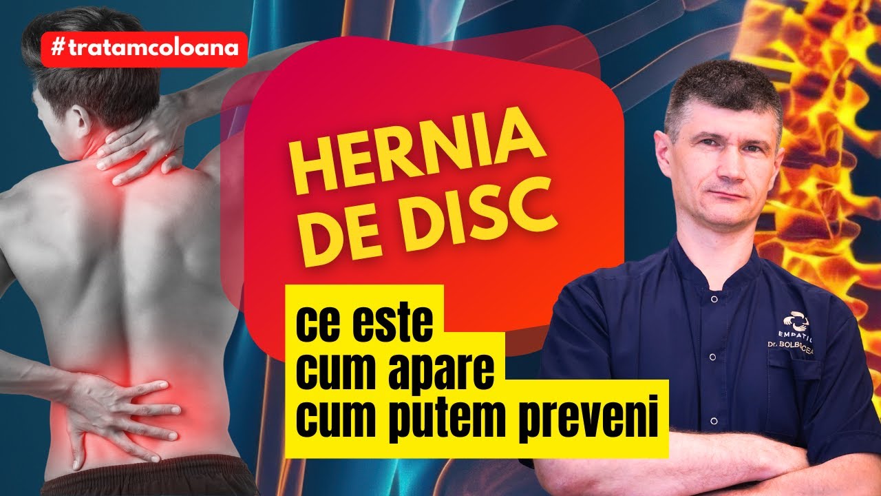 Ce este hernia de disc si cum apare. Cum putem preveni hernia. Explicații @DrOrestBolbocean Empatio