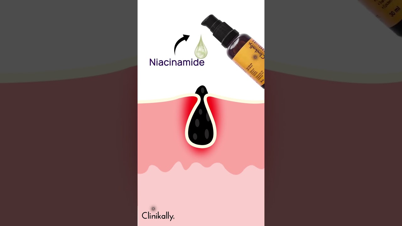 How Niacinamide Works on Acne & Dark Spots | Doctor's Skincare Tips