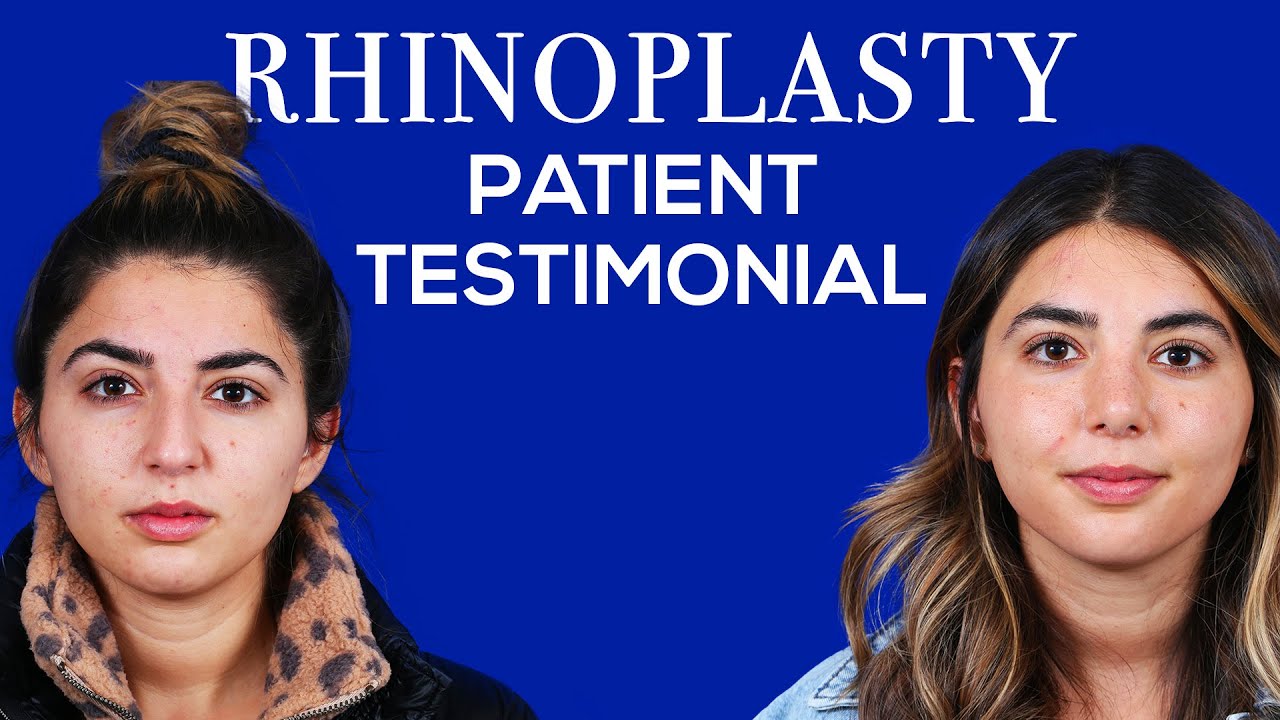 I Can Finally Breathe Again Thanks To Dr. Mourad! | Rhinoplasty Review | Dr. Moustafa Mourad
