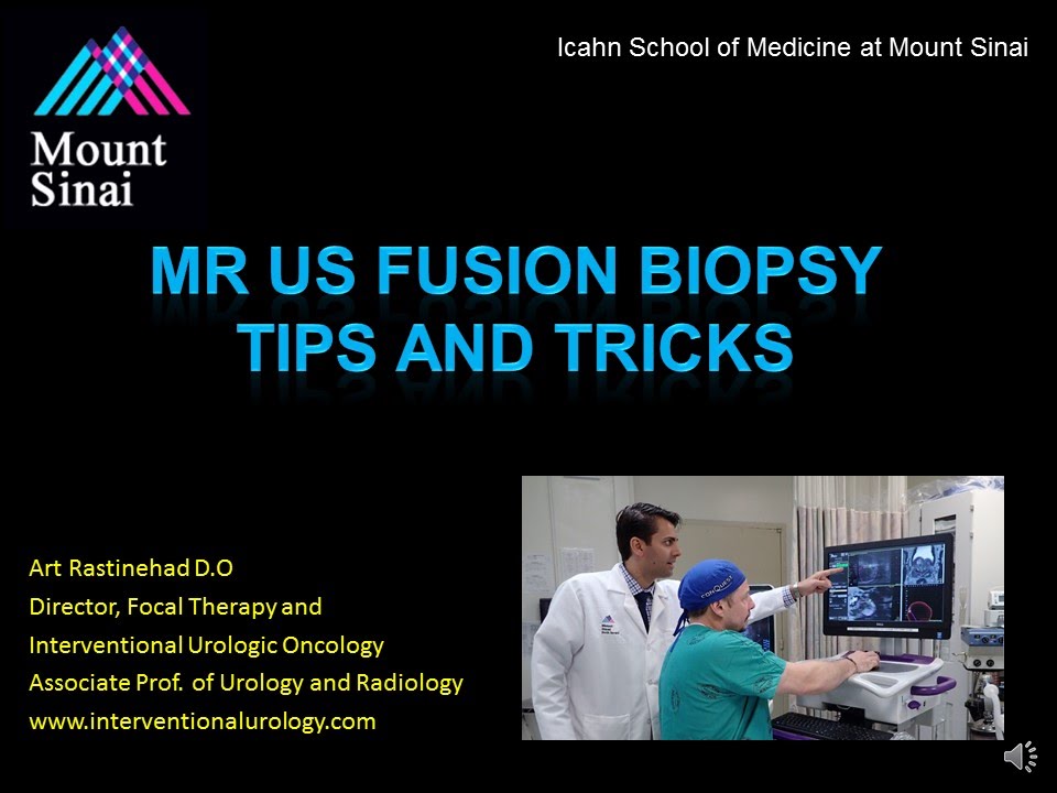 6  UroNav TIPS AND TRICKS Rastinehad Fusion Biopsy Youtube Video
