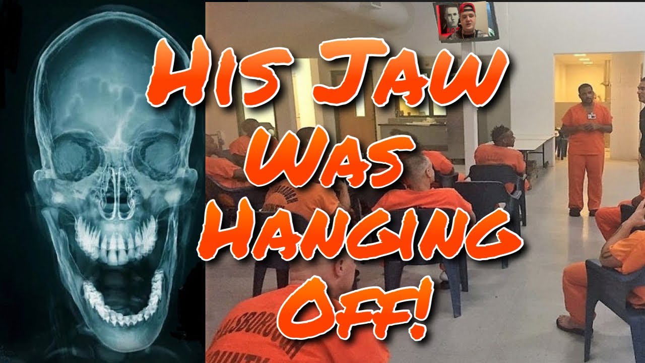 BROKEN JAW OVER THE JAIL TV