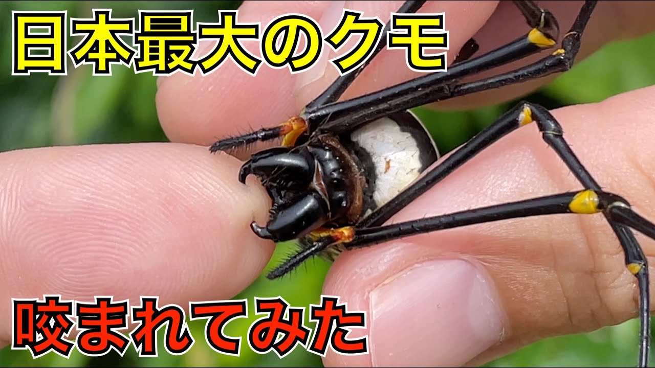 激痛！日本最大のクモに咬まれるとこうなります(オオジョロウグモ編)