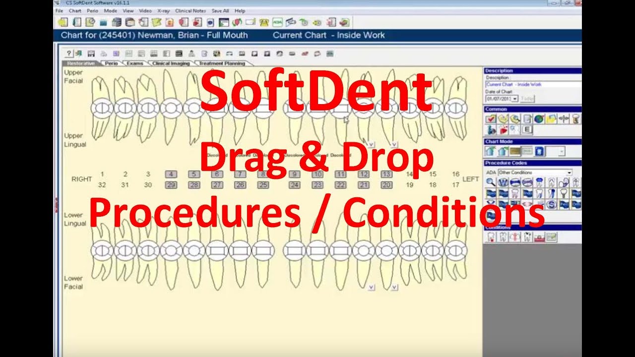 Drag and Drop Conditions and Procedures in SD Chart