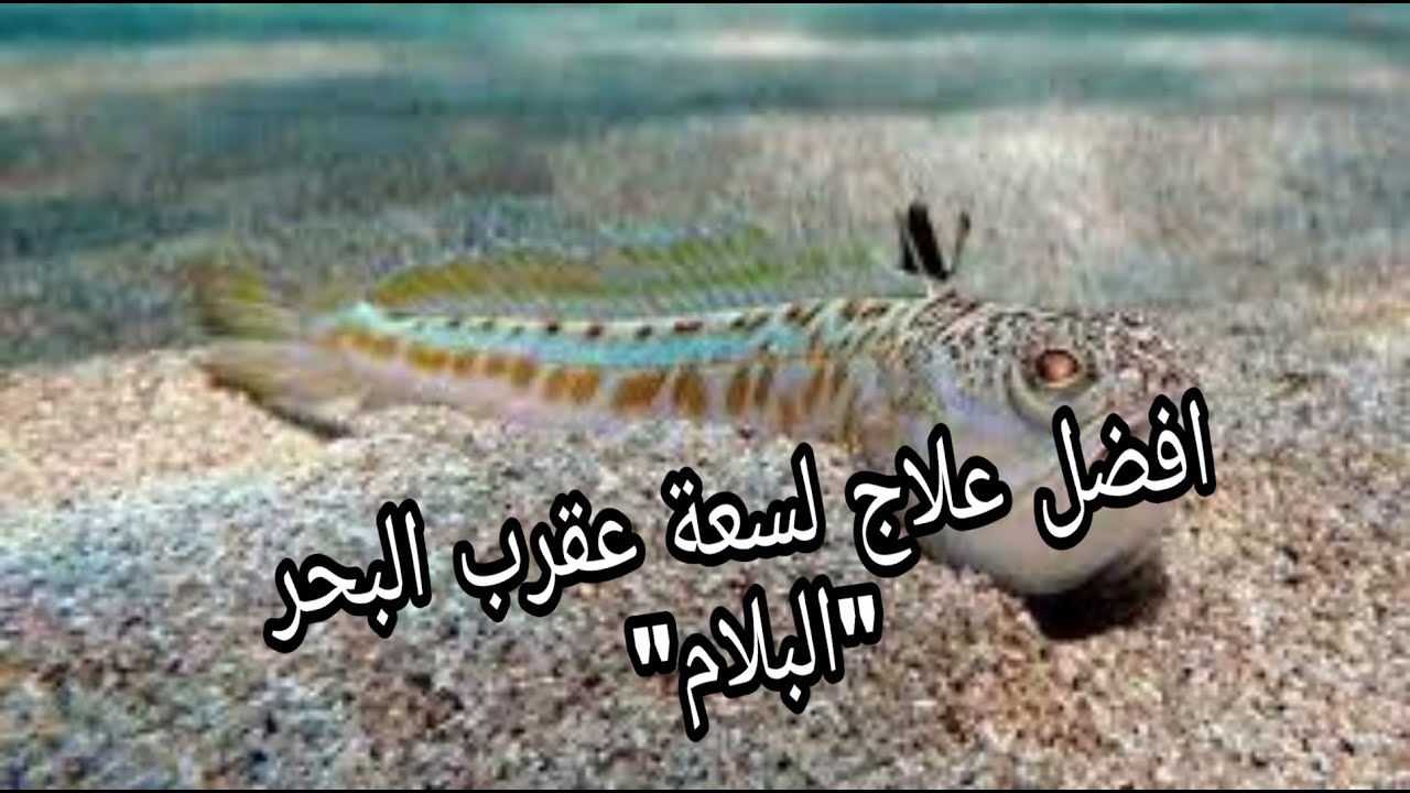 علاج لسعة  و سم عقرب البحر او البلام