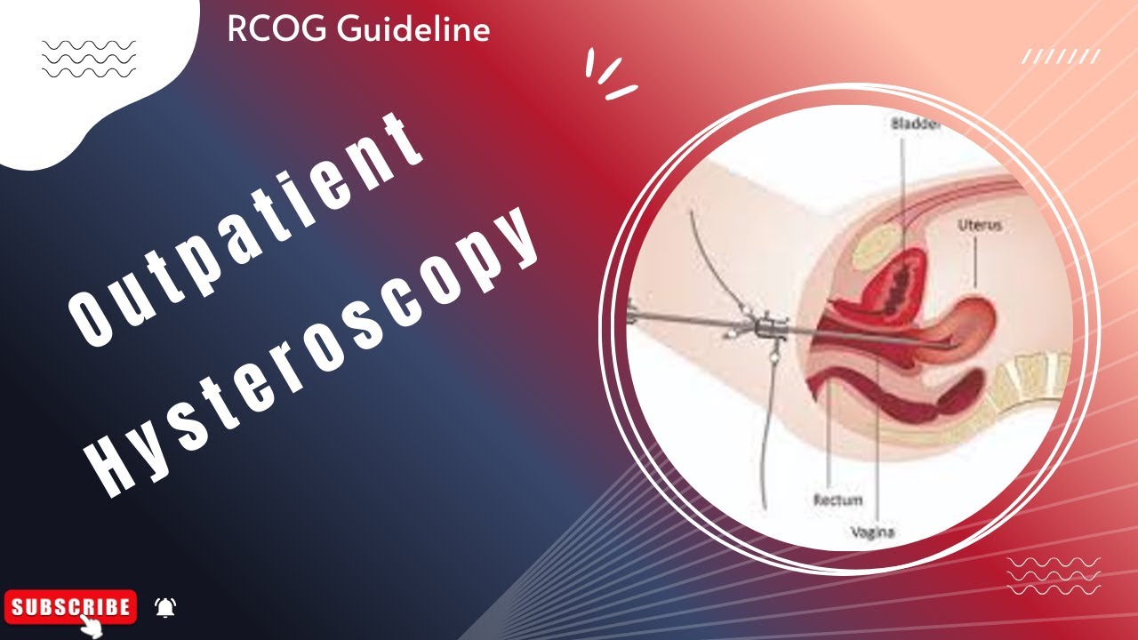 Outpatient Hysteroscopy RCOG Guideline (August 2024)
