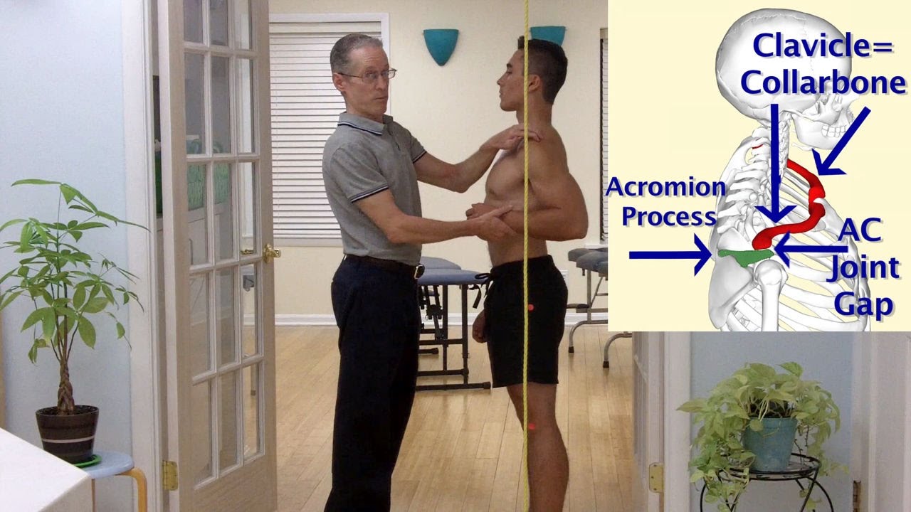 How to Evaluate Your Posture as Viewed from the Side