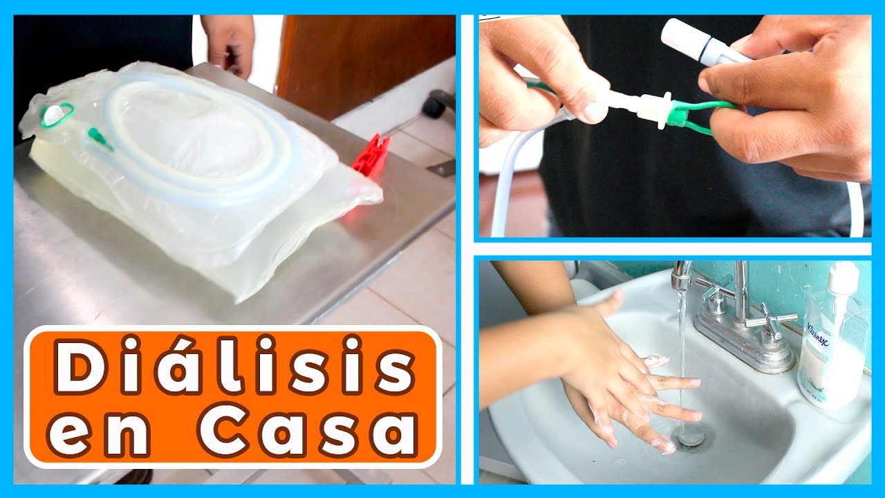 Como hacer la DIALISIS EN CASA &iexcl;F&Aacute;CIL! 🔴😎 BAXTER | Junica IRC