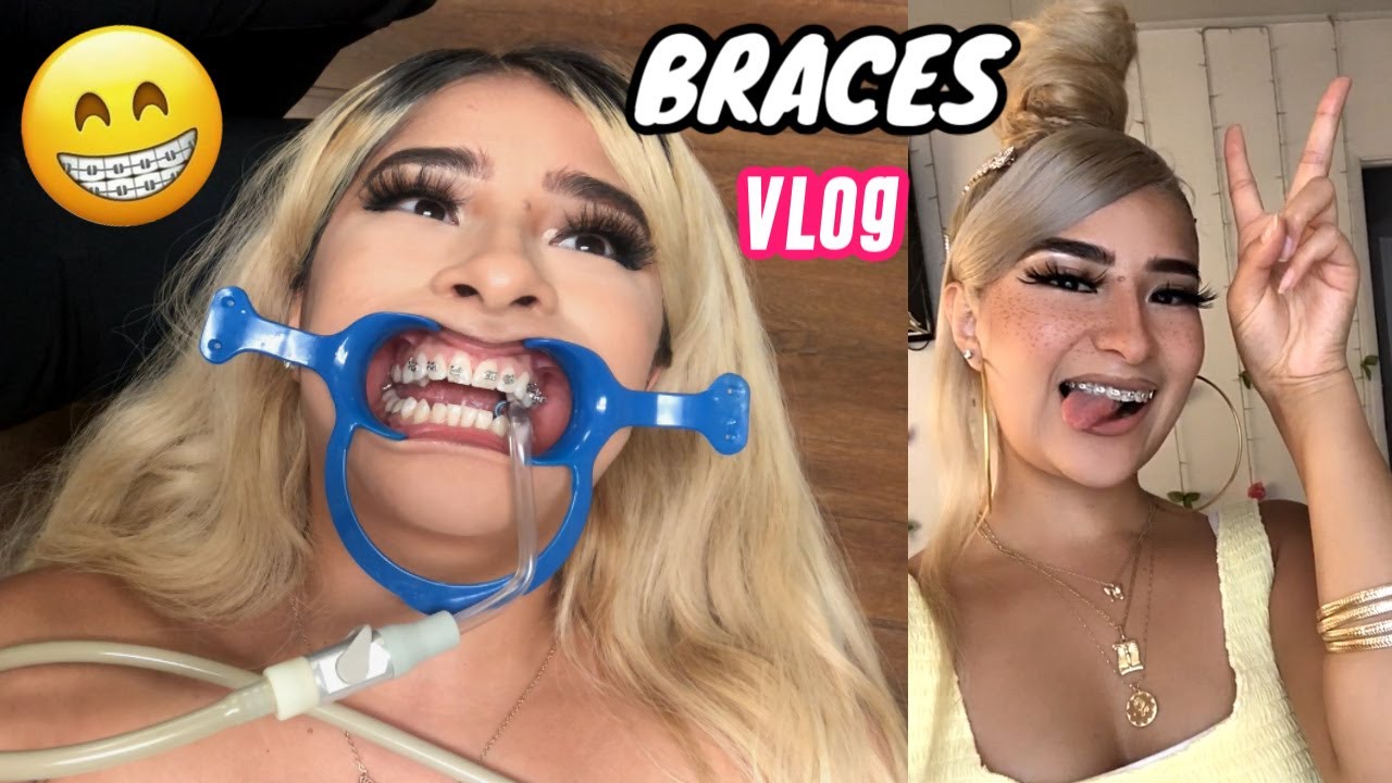 COME WITH ME TO GET BRACES VLOG | PT.1