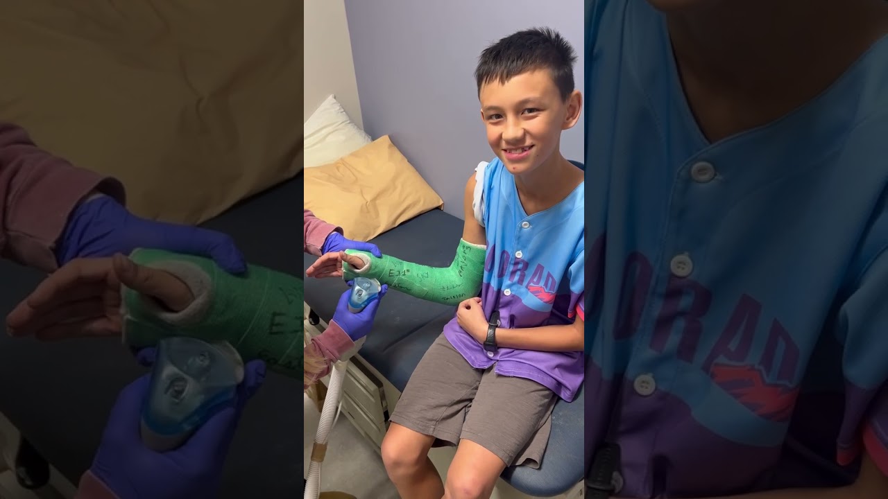 | Taking Cast Off | Fractured right elbow | 11/26/25 #momofboys #NBA #shorts #fyp 