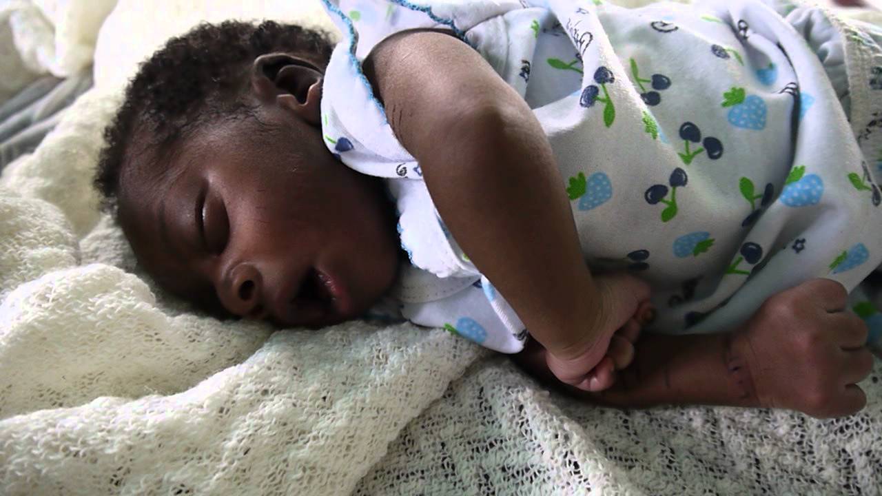 Tetanus spasms in a newborn