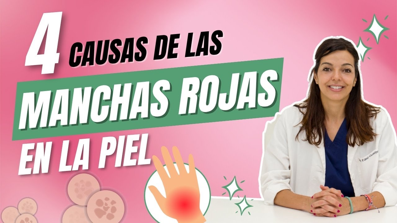 4 Causas de las Manchas Rojas en la piel