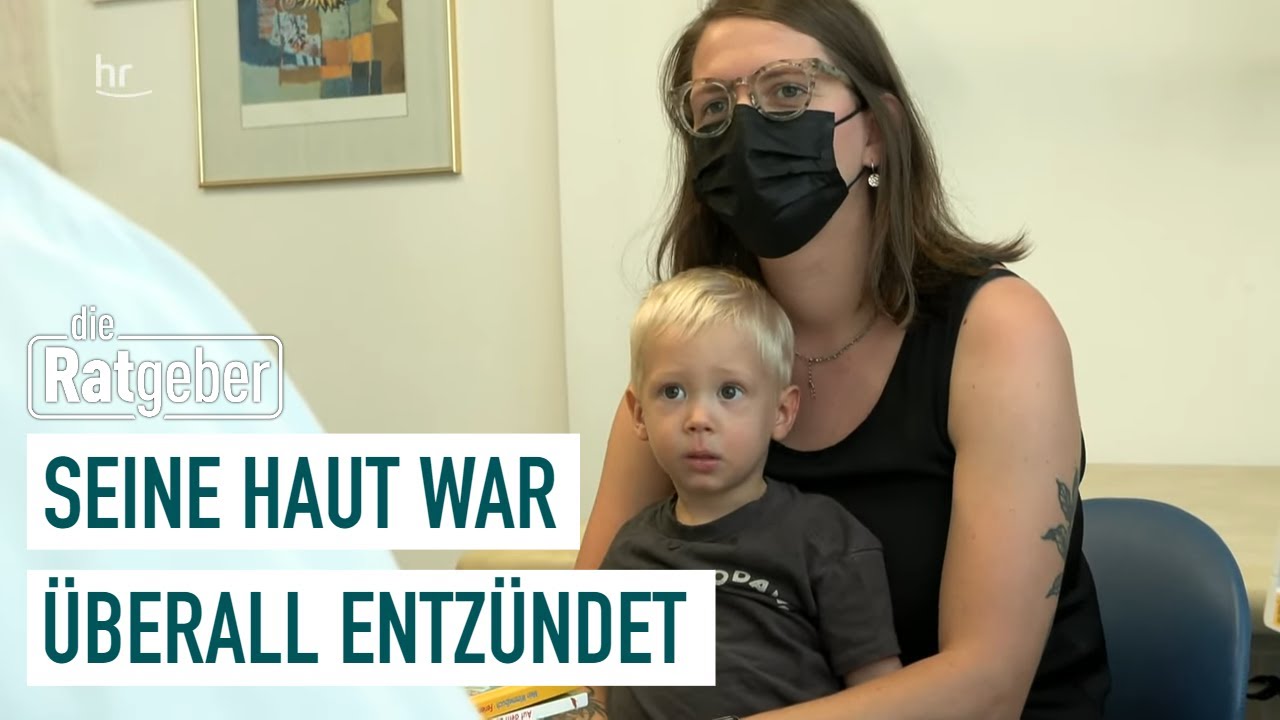 Schwere Neurodermitis: Wie ein Medikament Rubens Leben veränderte | Gesundmacher 4/5 | die Ratgeber