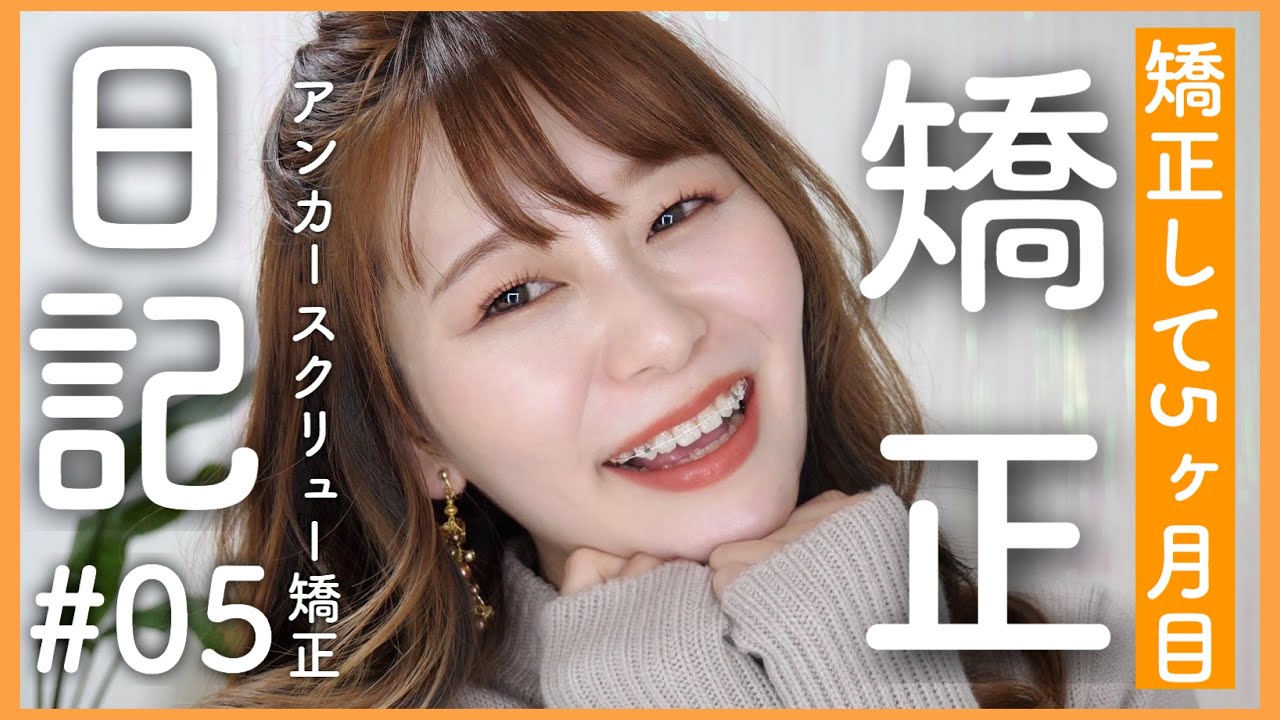 【矯正日記#05】5ヶ月目経過報告🌈ホワイトニングケアについても！by 桃桃