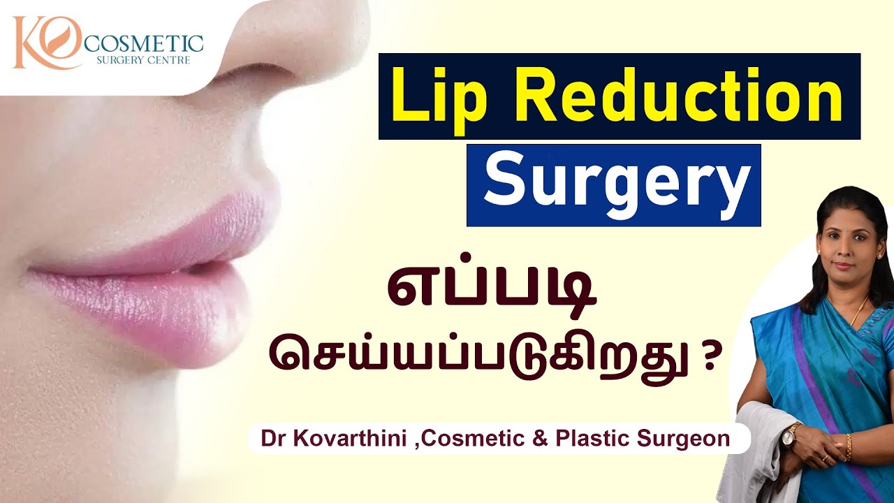 Lip Reduction Surgery எப்படி செய்யப்படுகிறது  ? | Ko Cosmetic Surgery Centre |  Dr. Kovarthini