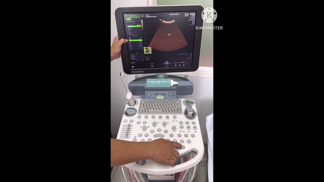 How to manipulate GE Voluson P8 ultrasound
